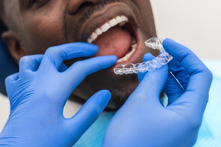 The Step-by-Step Clear Aligner Process by Horizon Dental Designs
