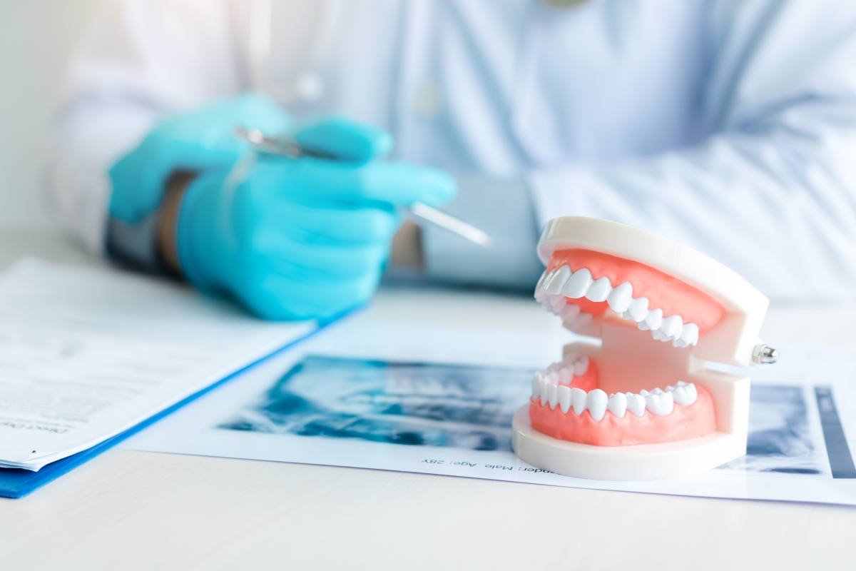 My Implant Crown Fell Off — Is That Normal? What to Do Next
