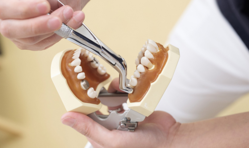Nervous About Tooth Extraction in Plant City? What Patients Should Expect