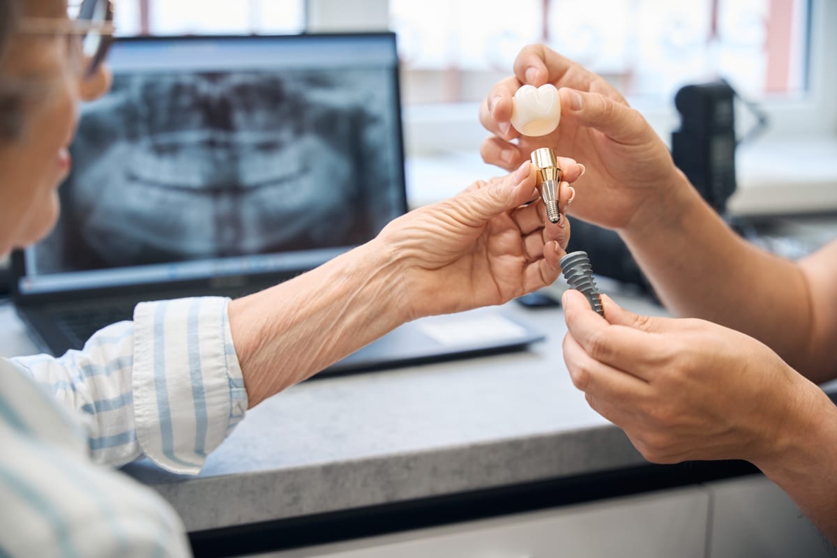 Your Dental Implant Recovery Timeline: Week by Week Guide
