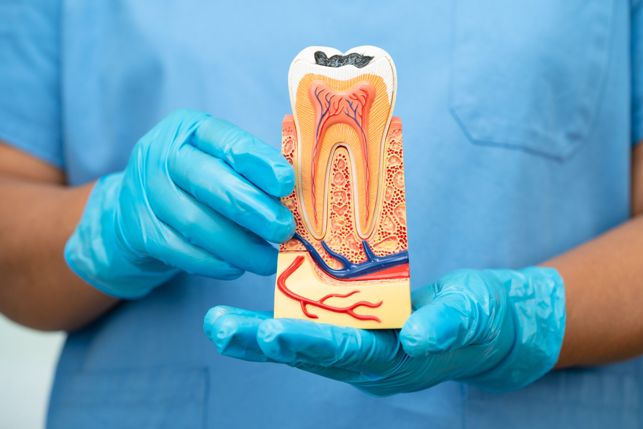 a dentist holding an artificial root canal in Plant City FL