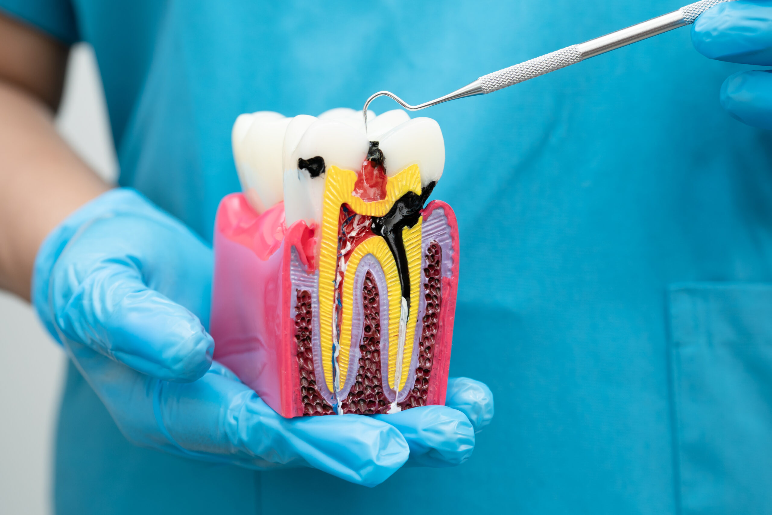 A dentist holding a root canal in Plant City FL